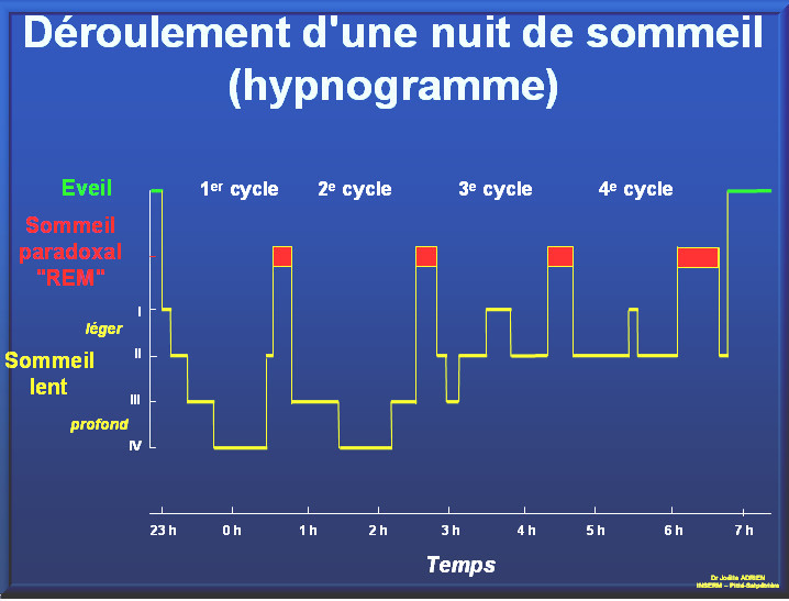 déroulement d'une nuit de sommail (hypnogramme)